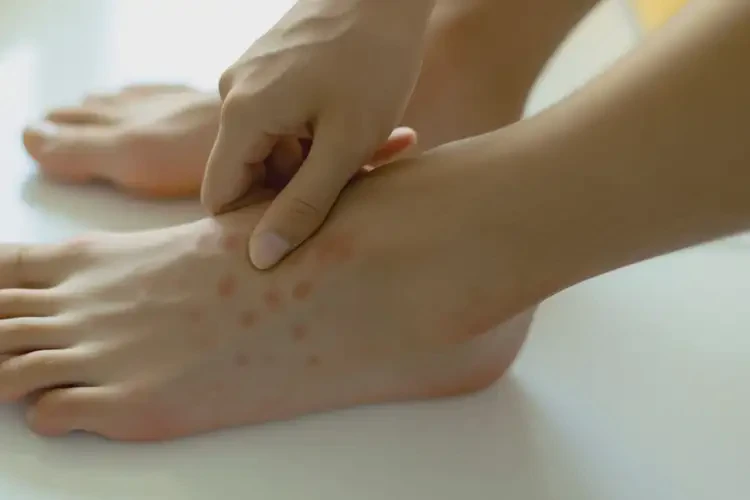 男人腳上偶爾長(zhǎng)濕疹能徹底自愈嗎(圖4)