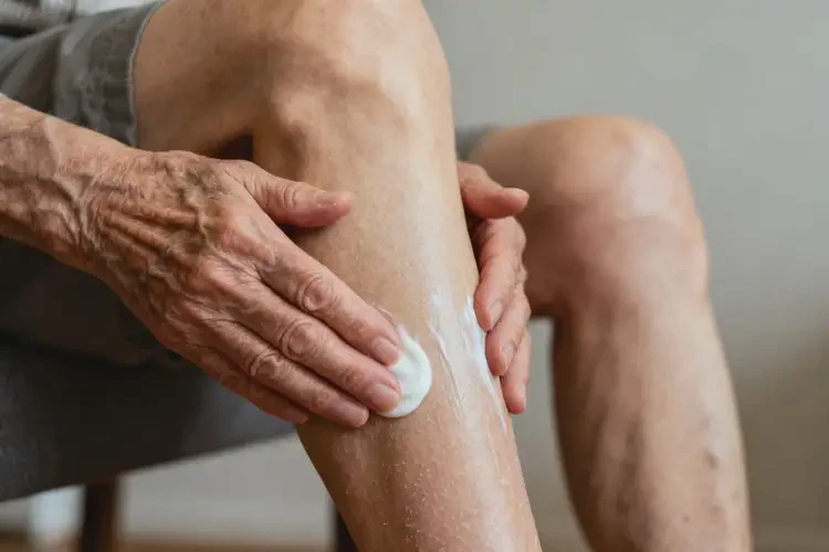 高齡老人小腿出現(xiàn)濕疹能不能徹底自愈(圖4)