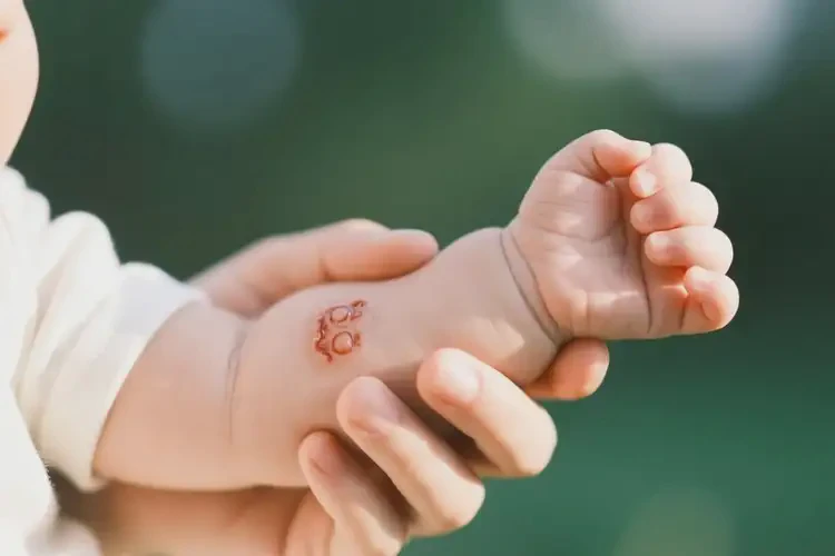 孩子手臂上容易起濕疹不管它會自己自愈嗎(圖1)