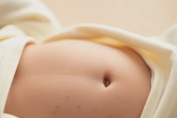寶寶肚子上偶爾長(zhǎng)濕疹能徹底自愈嗎(圖2)