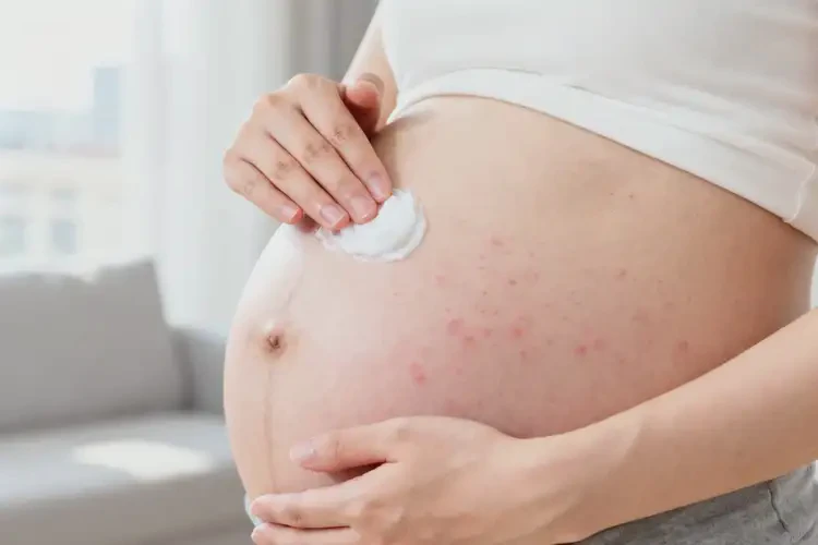 孕婦肚子上容易長濕疹不管它會(huì)自己好嗎(圖2)
