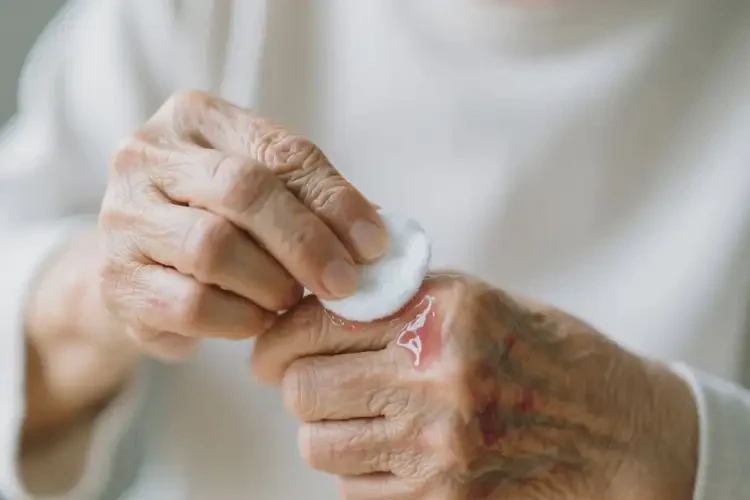 高龄老人身上出湿疹不管它会自己自愈吗(图3)