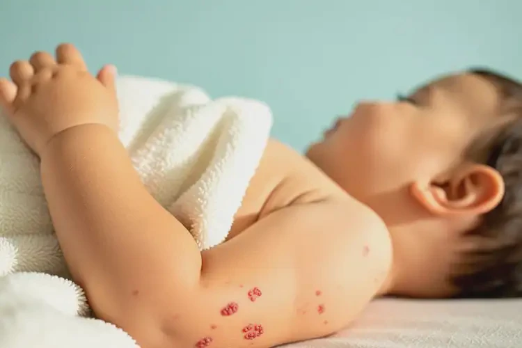 幼兒全身容易長濕疹不管它會自己痊愈嗎(圖4)