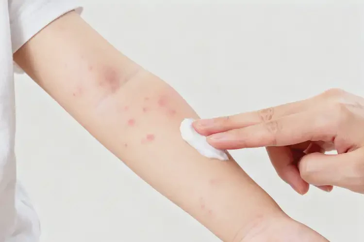 小孩手臂偶尔起湿疹能够彻底治愈吗(图1)