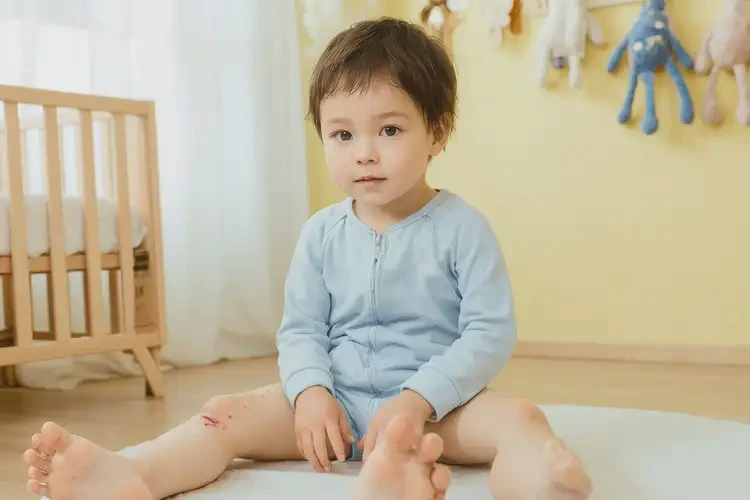 孩子大腿上容易長(zhǎng)濕疹能徹底自愈嗎(圖1)