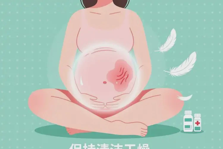 孕婦屁股容易起濕疹可不可以徹底自愈(圖3)