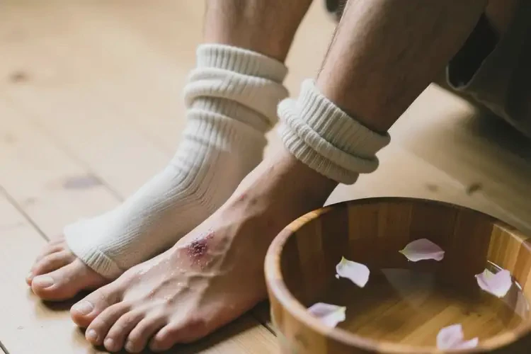 男人腳上長濕疹不管它會自己自愈嗎(圖1)