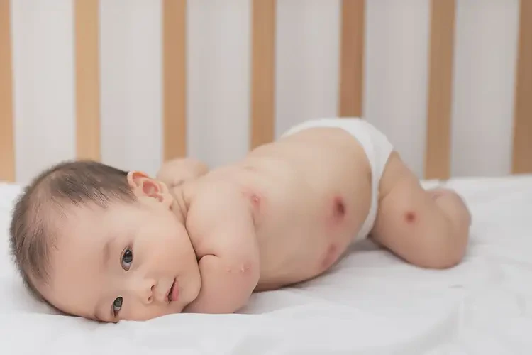 寶寶全身偶爾起濕疹不管它會(huì)自己痊愈嗎(圖4)