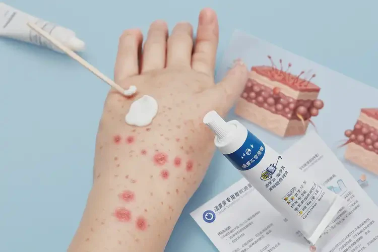 小兒手上容易長濕疹能靠自己自愈嗎(圖3)