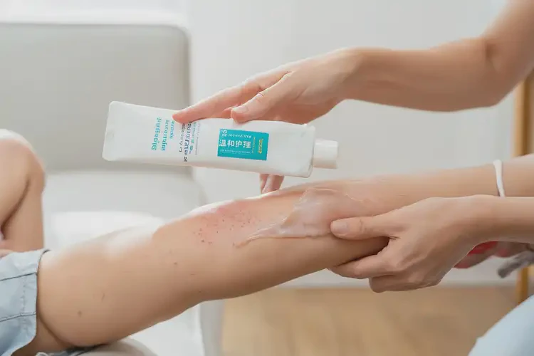 兒童小腿經(jīng)常長濕疹不管它會自己自愈嗎(圖3)