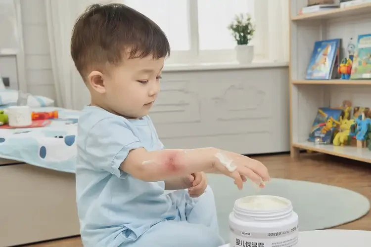 小孩手臂上長濕疹可以徹底自愈嗎(圖1)