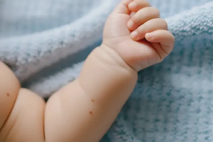 嬰兒手臂偶爾長濕疹不管它會自己好嗎(圖1)