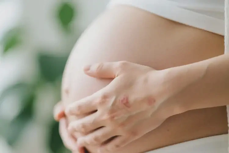 孕婦身上出現(xiàn)濕疹不管它會自己自愈嗎(圖4)