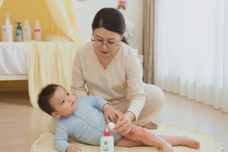 幼兒大腿起濕疹可以徹底自愈嗎(圖3)