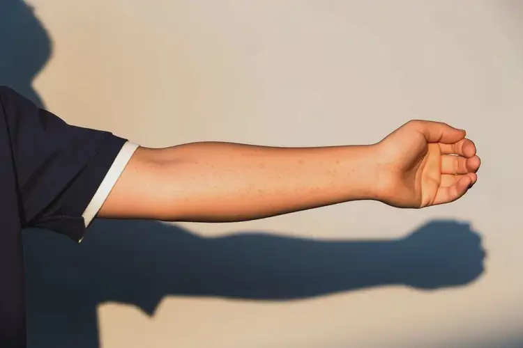 青年人手臂容易起濕疹不管它會(huì)自己自愈嗎(圖2)