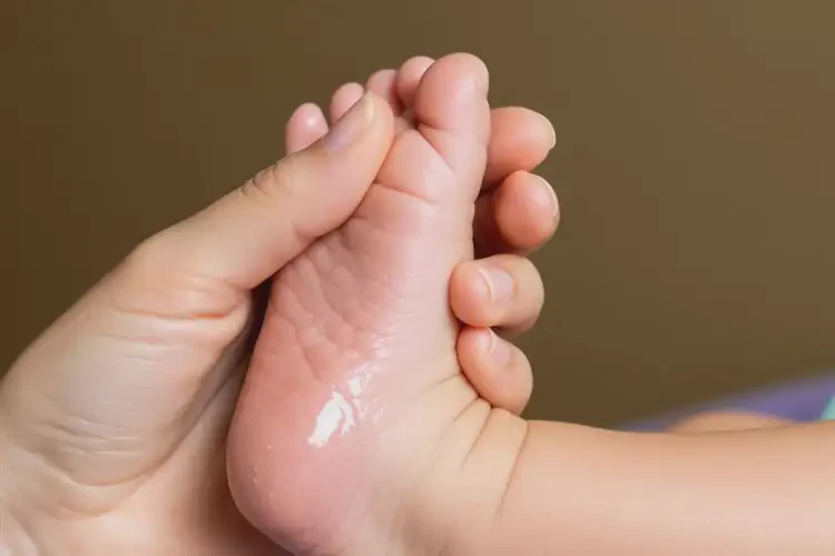 嬰兒腳上經(jīng)常起濕疹不管它會(huì)自己自愈嗎(圖1)