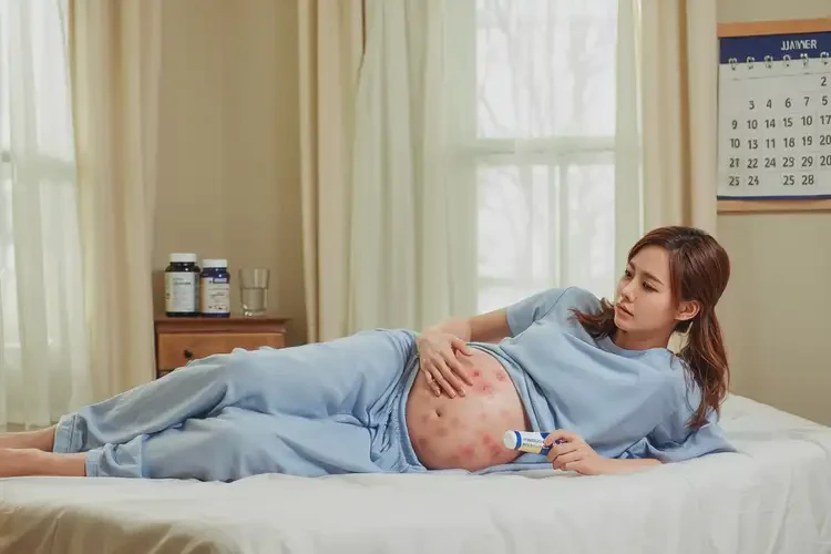 產(chǎn)婦肚子上長(zhǎng)濕疹能靠自己自愈嗎(圖1)