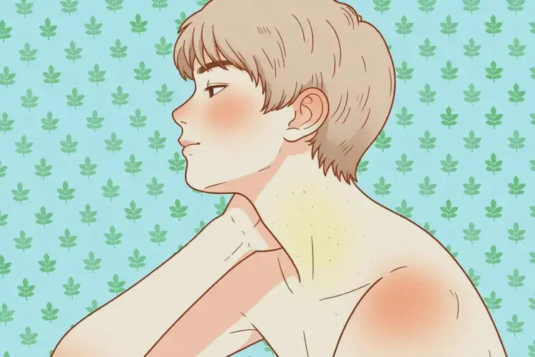 青少年脖子容易起濕疹可以徹底自愈嗎(圖4)