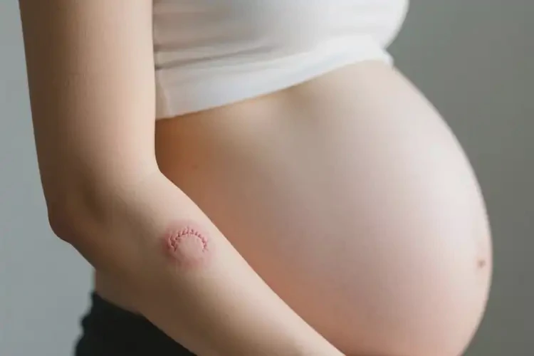 產(chǎn)婦手臂上偶爾長濕疹能徹底自愈嗎(圖1)