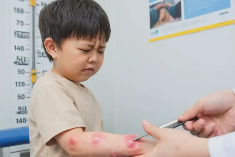 小孩手臂容易長(zhǎng)濕疹能徹底自愈嗎(圖4)