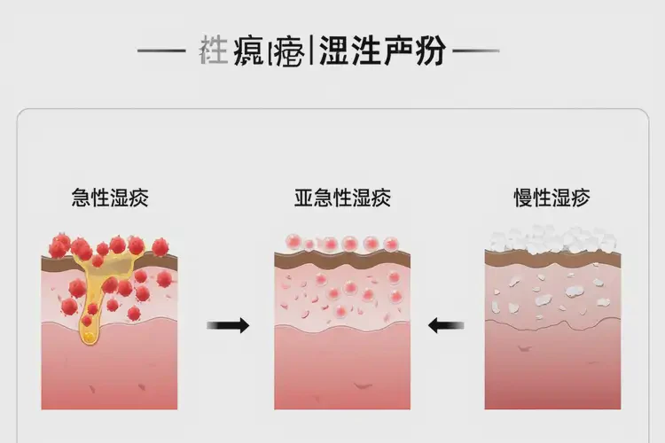 男人手上经常起湿疹不管它会自己自愈吗(图3)