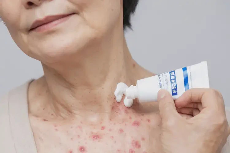 女生脖子偶尔起湿疹不管它会自己好吗(图2)