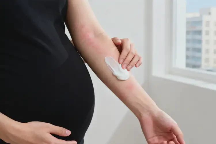 孕妇手臂上偶尔长湿疹可不可以彻底自愈(图1)