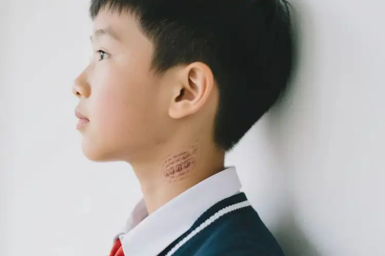 中學(xué)生脖子上經(jīng)常起濕疹不管它會(huì)自己好嗎(圖2)