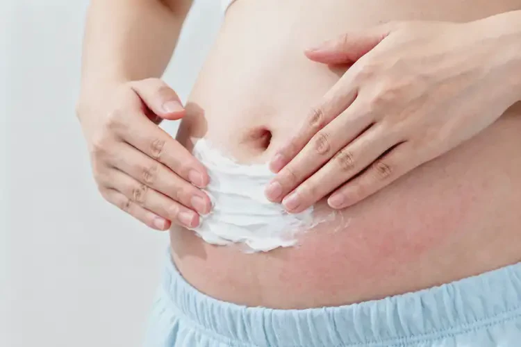 女性肚子有濕疹能徹底自愈嗎(圖1)