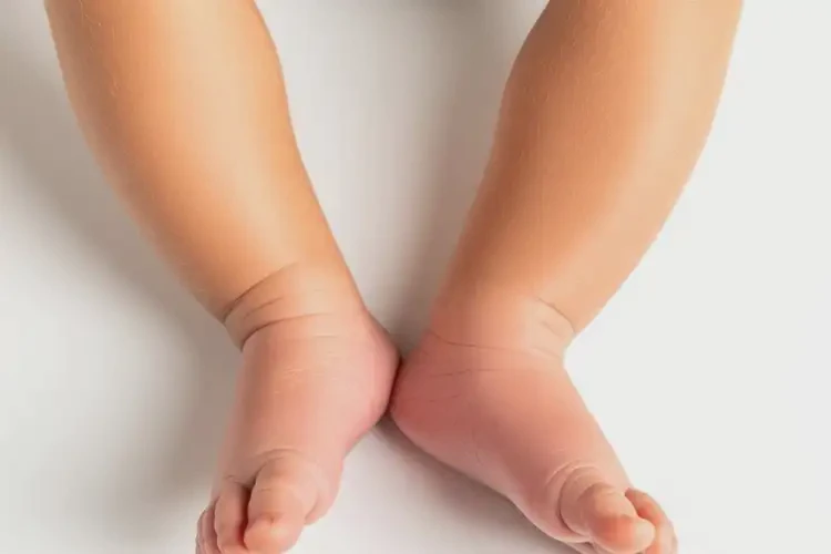 新生兒小腿上起濕疹可以徹底自愈嗎(圖1)