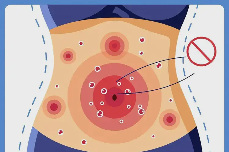 女生肚子上出現(xiàn)濕疹不管它會(huì)自己好嗎(圖1)