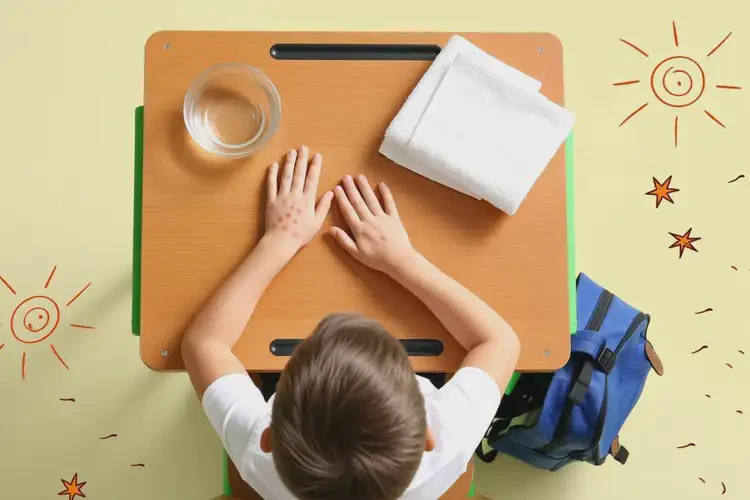 小學(xué)生四肢有濕疹能靠自己自愈嗎(圖1)