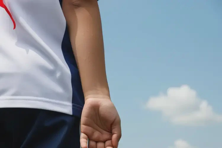 中學生手臂上出現(xiàn)濕疹能不能徹底自愈(圖1)