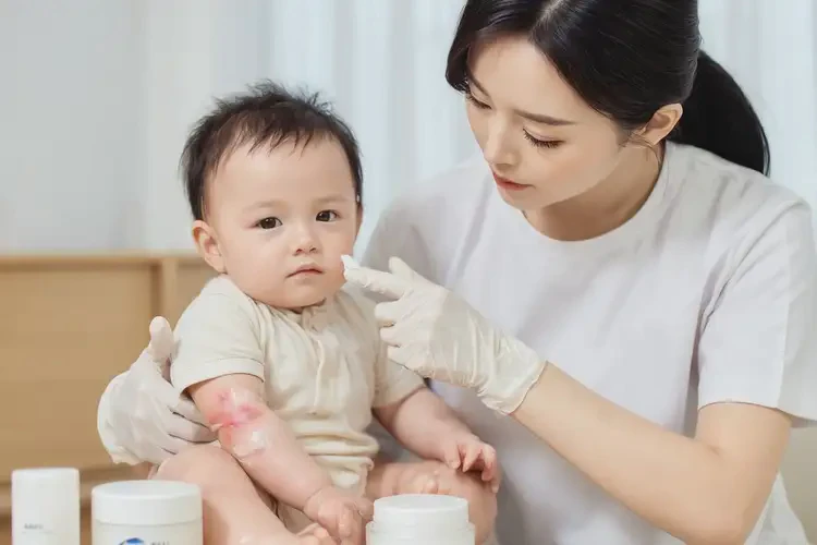 嬰幼兒面部容易起濕疹能夠徹底治愈嗎(圖3)