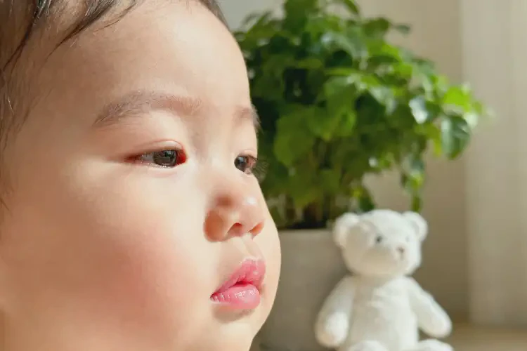 幼兒臉上偶爾起濕疹可以徹底自愈嗎(圖2)