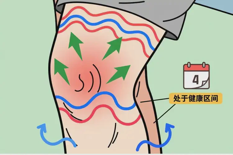 老年人大腿上容易長(zhǎng)濕疹不管它會(huì)自己痊愈嗎(圖2)