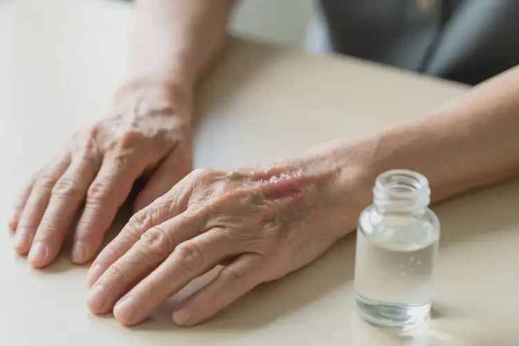 老年人手上有濕疹可不可以徹底自愈(圖3)
