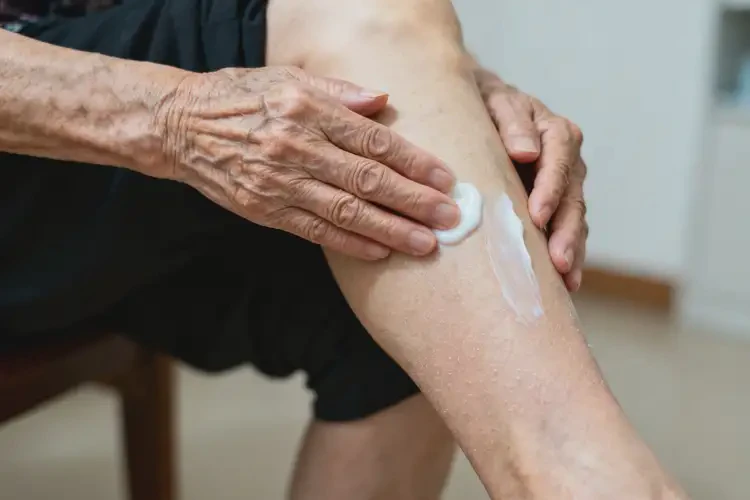 高齡老人小腿出現(xiàn)濕疹能不能徹底自愈(圖3)