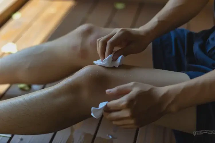 男性大腿偶爾起濕疹能夠徹底治愈嗎(圖3)