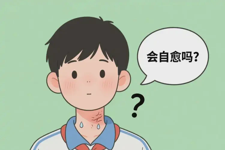 中學(xué)生脖子長濕疹不管它會自己自愈嗎(圖2)