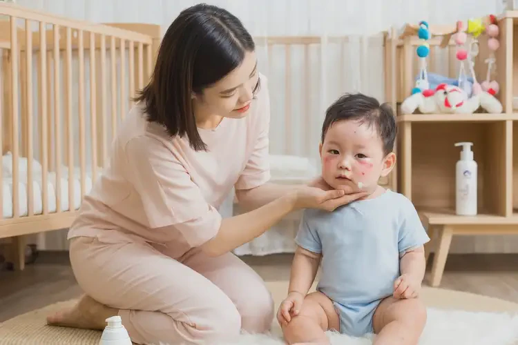 嬰幼兒身上偶爾長濕疹能徹底自愈嗎(圖3)
