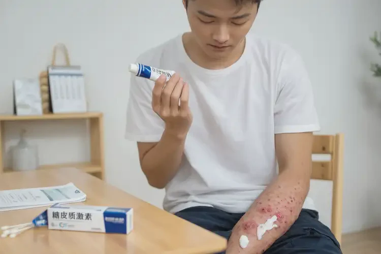 青年人大腿上長(zhǎng)濕疹能夠徹底治愈嗎(圖3)