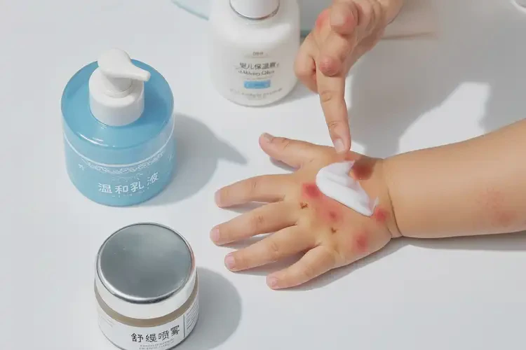 小兒手上容易長濕疹能靠自己自愈嗎(圖2)