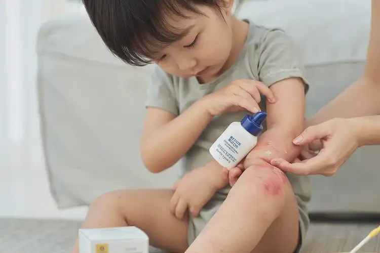 儿童四肢出湿疹可不可以彻底自愈(图3)