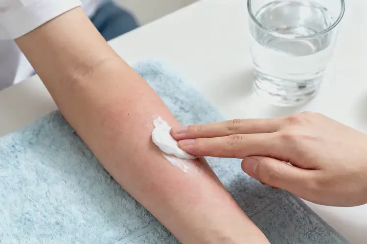 青少年四肢長(zhǎng)濕疹可不可以徹底自愈(圖1)