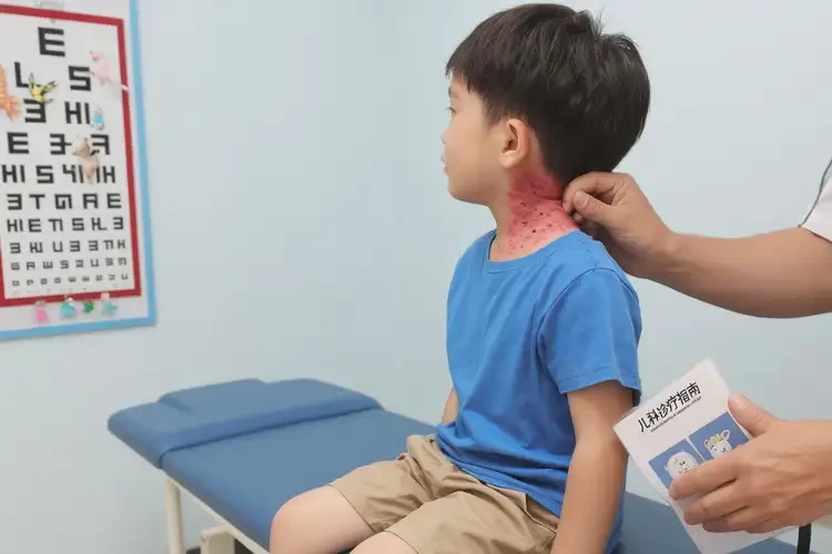 孩子脖子长湿疹不管它会自己痊愈吗(图4)