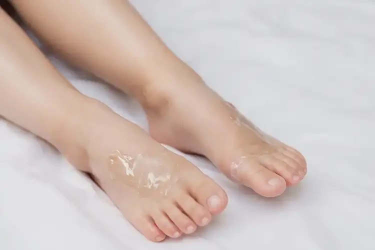 少兒腳上出濕疹能靠自己自愈嗎(圖1)