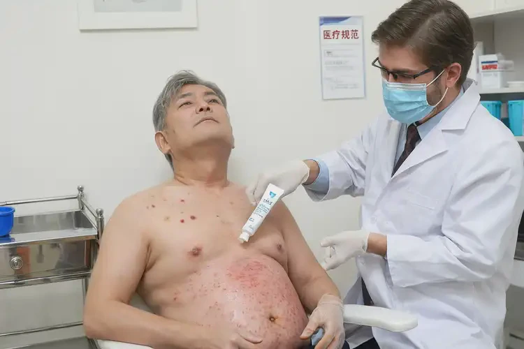 男性肚子上出現(xiàn)濕疹可不可以徹底自愈(圖3)