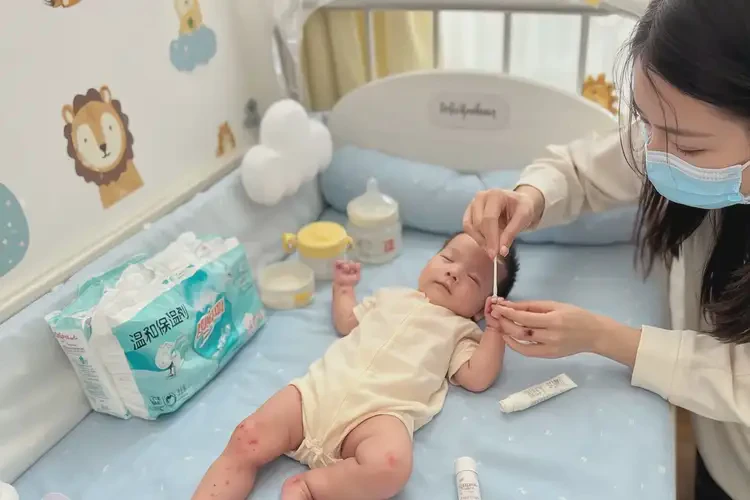 寶寶全身經(jīng)常起濕疹能夠徹底治愈嗎(圖2)