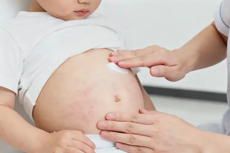 幼兒肚子長濕疹不管它會自己自愈嗎(圖4)
